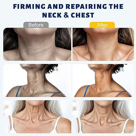 SEAGRIL™ 5-Roller Neck Firming Cream – Collagen & Hyaluronic Acid for Smoother, Tighter-Looking Neck Skin