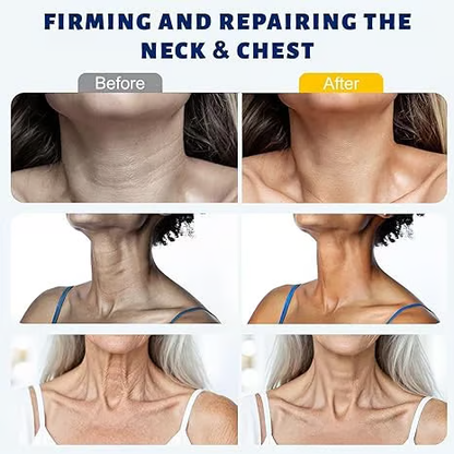 SEAGRIL™ 5-Roller Neck Firming Cream – Collagen & Hyaluronic Acid for Smoother, Tighter-Looking Neck Skin