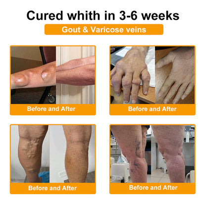 🎁Flash Sale - SEAGRIL™ Botulinum Toxin & Bee Venom Pain-Relief Bone Healing Cream🐝💎