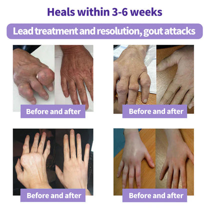 2026⏰Black Friday Limited-Time Special Offer: BUY 1 GET 1 FREE🔥SEAGRIL™ Turmeric & Emu Oil Arthritis Soothing Pain Relief Massage Gel 👨‍⚕️ American Osteopathic Association (AOA) Approved