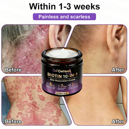 ✨Made and Shipped from USA ✨Yagoo® Biotin 10-in-1 Skin Restoration Cream 🍀