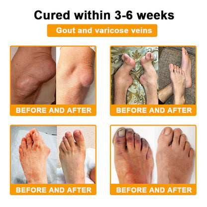 🎁Flash Sale - SEAGRIL™ Botulinum Toxin & Bee Venom Pain-Relief Bone Healing Cream🐝💎
