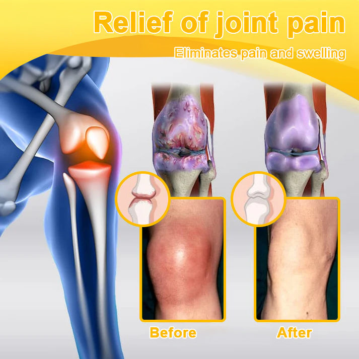 🎁Flash Sale - SEAGRIL™ Botulinum Toxin & Bee Venom Pain-Relief Bone Healing Cream🐝💎