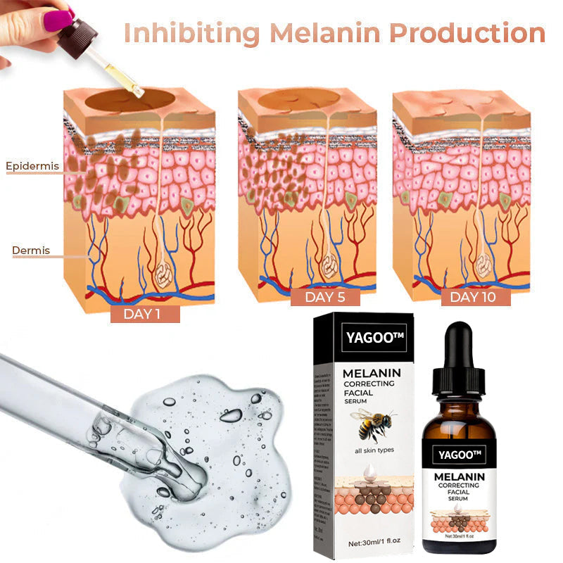 ✨Fast Dark Spot Remover-YAGOO™  Melanin Correcting Facial Serum(🔥Last Day Promotion 60% OFF)