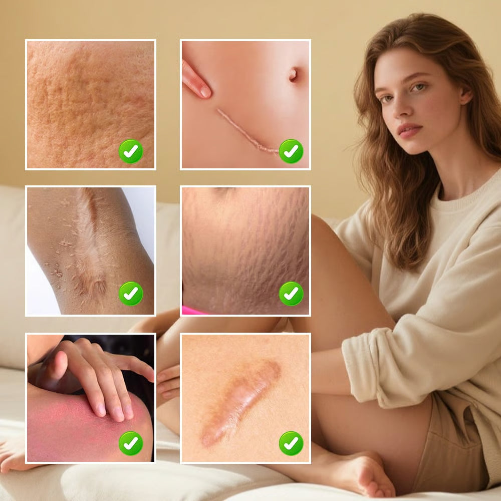 Scar Repair Cream for Men and Women, fade scars and tighten skin in one step