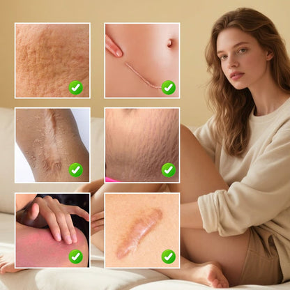 Scar Repair Cream for Men and Women, fade scars and tighten skin in one step